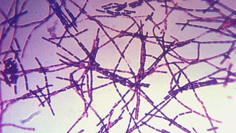 Bacillus anthracis läggs åt sidan i Postnords nya sorteringstjänst. Bacillus anthracis läggs åt sidan i Postnords nya sorteringstjänst.